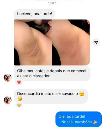 Relato de uso do clareador nas axilas